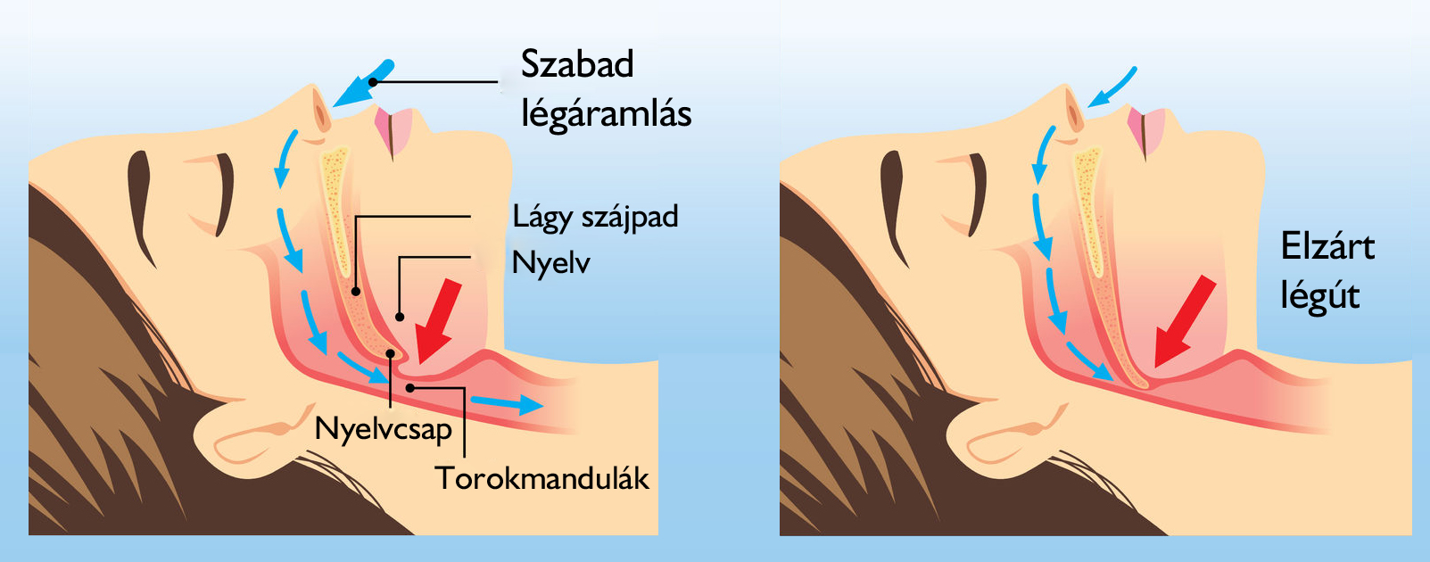 Horkolás anatómiája