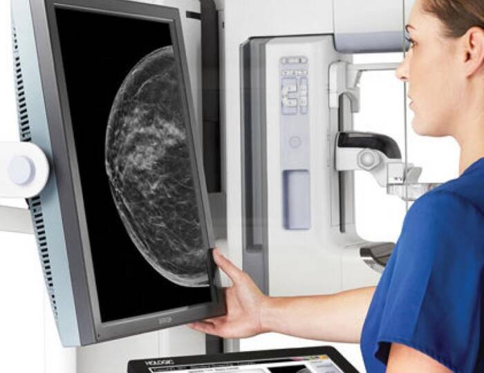 Mammográfiás vizsgálat