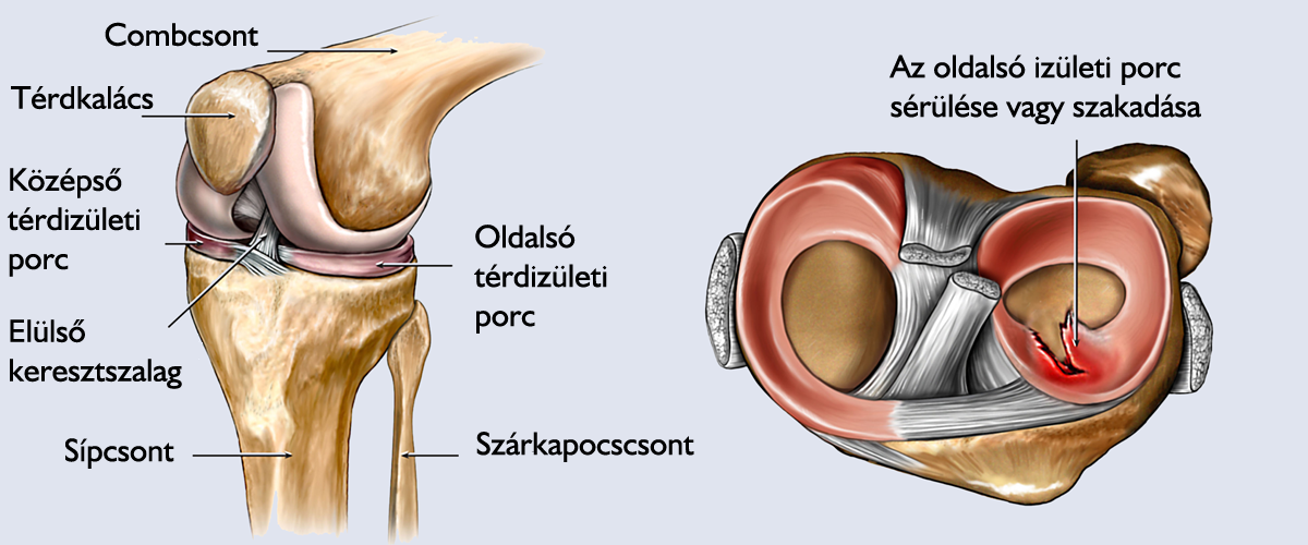 Ortopédia (ÁOK, 2020/21, IV.)