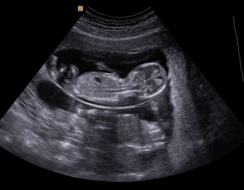 Hogyan zajlik a terhességi ultrahang?